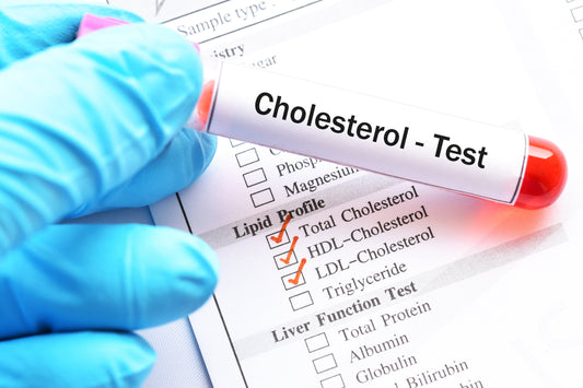 Cholesterol Test