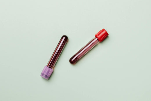 Blood samples used to test testosterone levels
